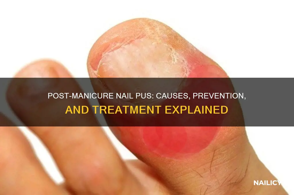 why is my nail pussing after a maniicure