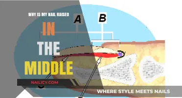 Why Is My Nail Raised in the Middle? Causes and Solutions