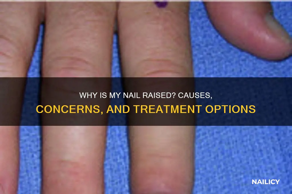 why is my nail raised