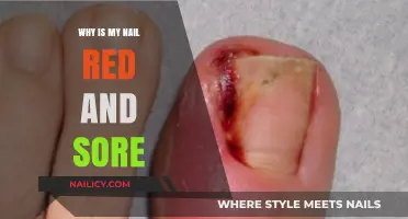 Red and Sore Toenail? Causes, Remedies, and When to Seek Help