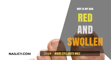 Red and Swollen Nails: Causes, Concerns, and Effective Remedies Explained