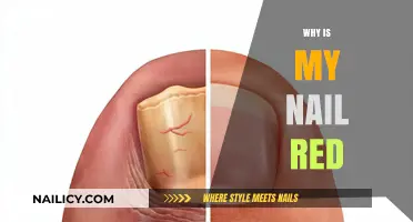 Red Nails Explained: Causes, Concerns, and When to Seek Help