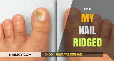 Why Are My Nails Ridged? Causes and Solutions Explained
