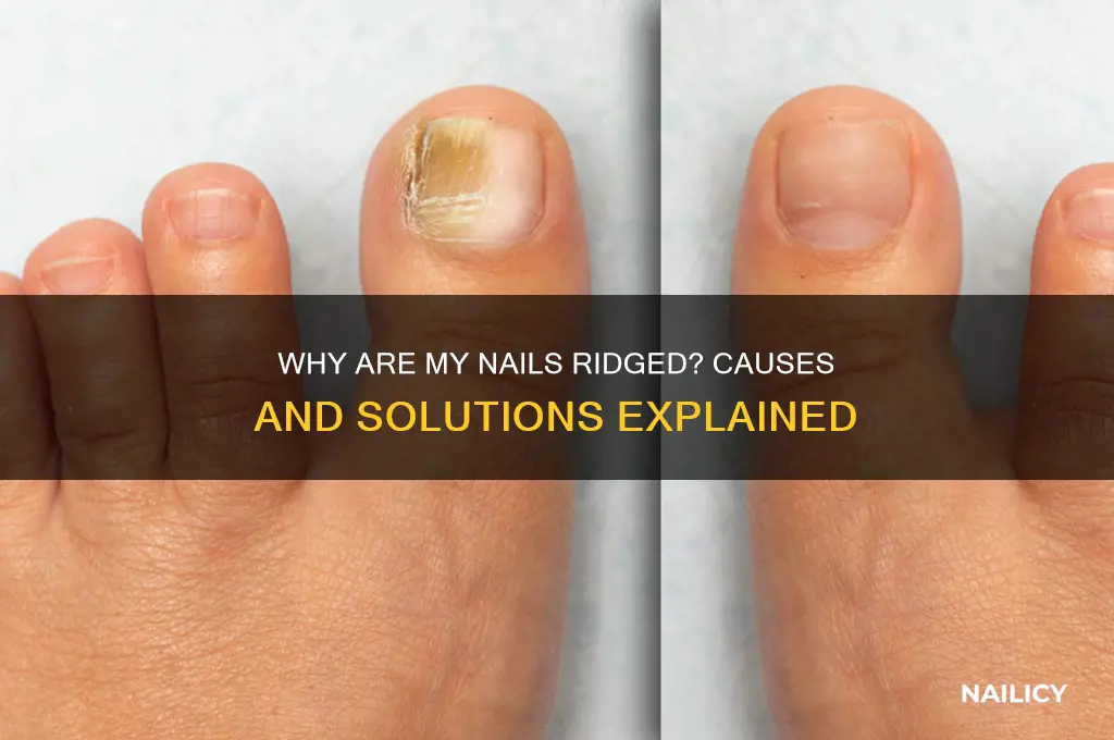 why is my nail ridged