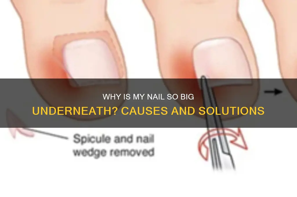 why is my nail so big underneath