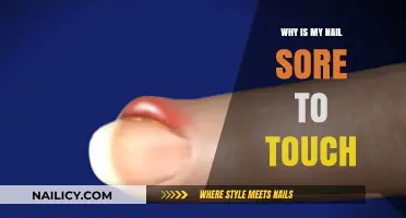Why Does My Nail Hurt When Touched? Causes and Remedies