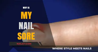 Why Is My Nail Sore? Causes, Remedies, and Prevention Tips
