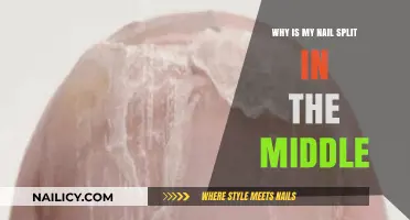 Why Is My Nail Split in the Middle? Causes and Solutions
