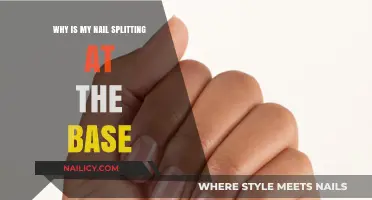 Why Is My Nail Splitting at the Base? Causes and Solutions