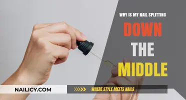 Why Is My Nail Splitting Down the Middle? Causes & Fixes