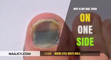 Why One Side of My Nail is Thick: Causes and Solutions