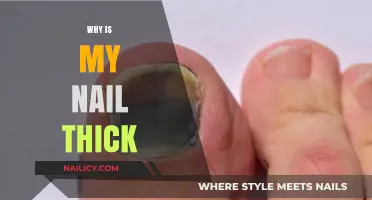 Why Is My Nail Thick? Causes, Concerns, and Effective Solutions