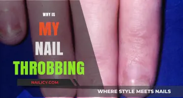 Why Is My Nail Throbbing? Causes, Remedies, and When to Worry