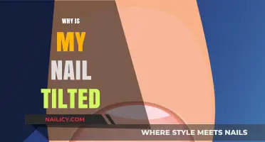 Why Is My Nail Tilted? Causes and Solutions Explained