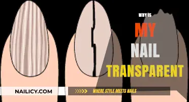 Why Are My Nails Transparent? Causes and Solutions Explained