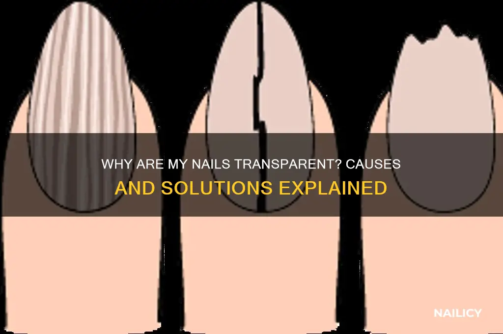 why is my nail transparent
