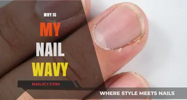 Why Are My Nails Wavy? Causes and Solutions Explained