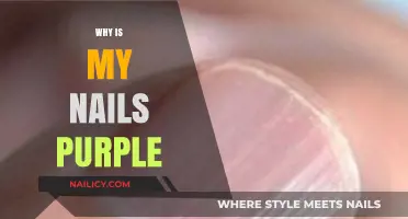 Why Are My Nails Purple? Causes and Solutions Explained
