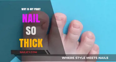 Why Is My Pinky Nail So Thick? Causes and Solutions Explained