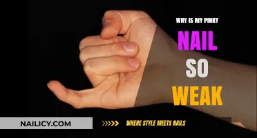 Weak Pinky Nail? Causes, Solutions, and Strengthening Tips Revealed