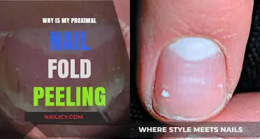 Proximal Nail Fold Peeling: Causes, Concerns, and Effective Solutions