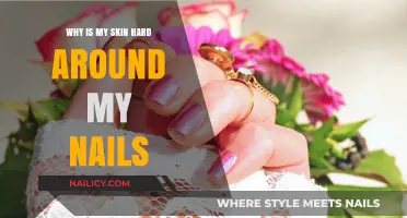 Why Skin Around Nails Hardens: Causes and Solutions Explained