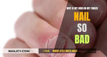 Skin Flakes and Bumps: Uncovering Nail Bed Issues