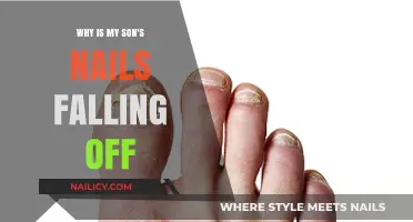 Understanding Why Your Son's Nails Are Falling Off: Causes and Solutions