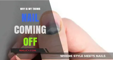 Why Is My Thumb Nail Coming Off? Causes and Solutions