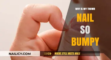 Bumpy Thumbnail? Causes and Solutions for Uneven Nail Texture