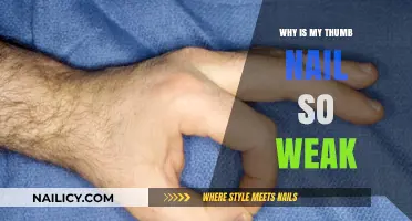Weak Thumb Nail? Causes, Prevention, and Strengthening Tips Revealed