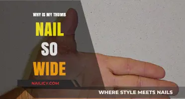 Why Is My Thumb Nail So Wide? Causes and Solutions Explained