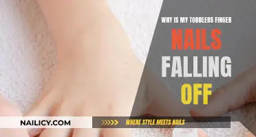 Toddler Fingernail Loss: What Parents Should Know