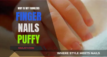 Toddler Puffy Nails: What Parents Should Know