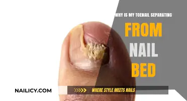 Toenail Separation: Causes, Symptoms, and Effective Treatment Options Explained