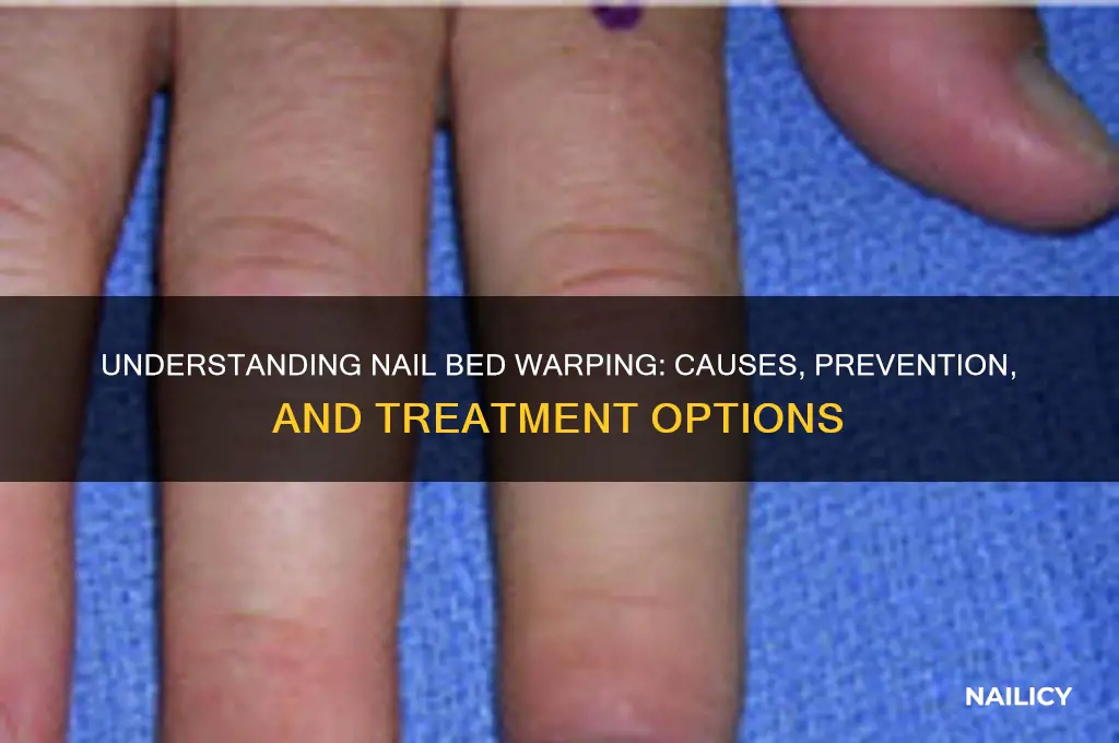 why is nail bed warping