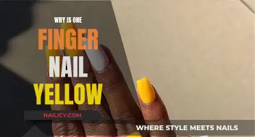 Yellow Nail: Understanding the Causes and When to Seek Help