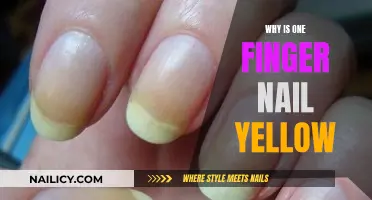 Yellow Fingernail: A Warning Sign You Shouldn't Ignore