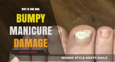 Bumpy Nail After Manicure: Causes and How to Prevent Damage