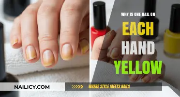 Yellow Nail Mystery: Causes and Solutions for Discolored Fingernails
