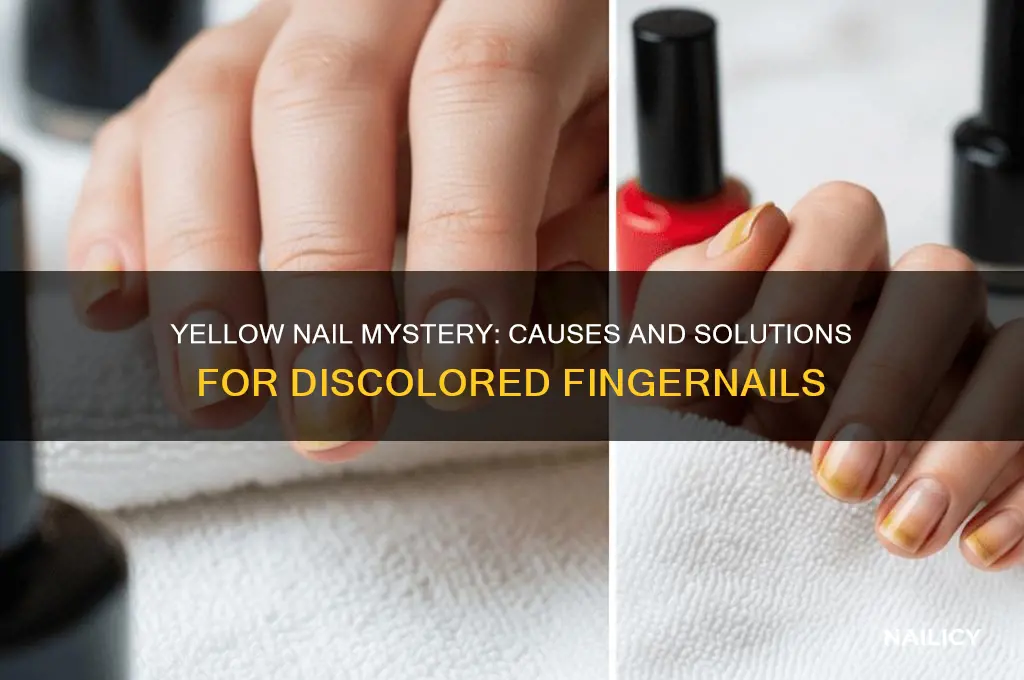 why is one nail on each hand yellow