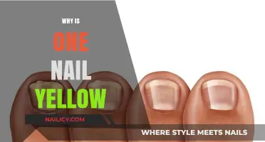 Why Is One Nail Yellow? Causes and Solutions Explained