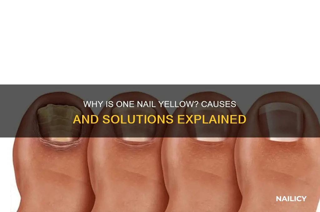 why is one nail yellow