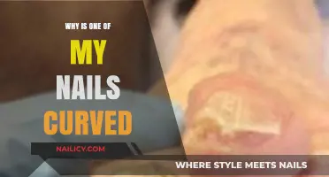 Curved Nail Concerns: Understanding the Causes and Solutions