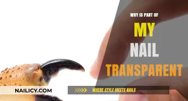 Why Is Part of My Nail Transparent? Causes and Solutions