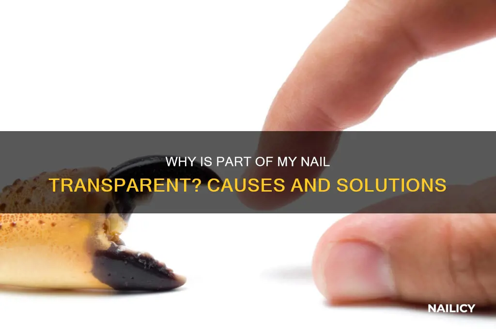 why is part of my nail transparent