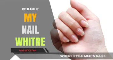 Why Is Part of My Nail White? Causes and Solutions Explained