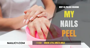 Why Polish Causes Peeling Nails: Understanding the Root Cause