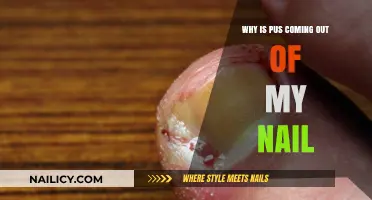 Pus Under Nail: Causes, Treatment, and Prevention Explained