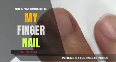 Puss Under Fingernails: What's the Cause?